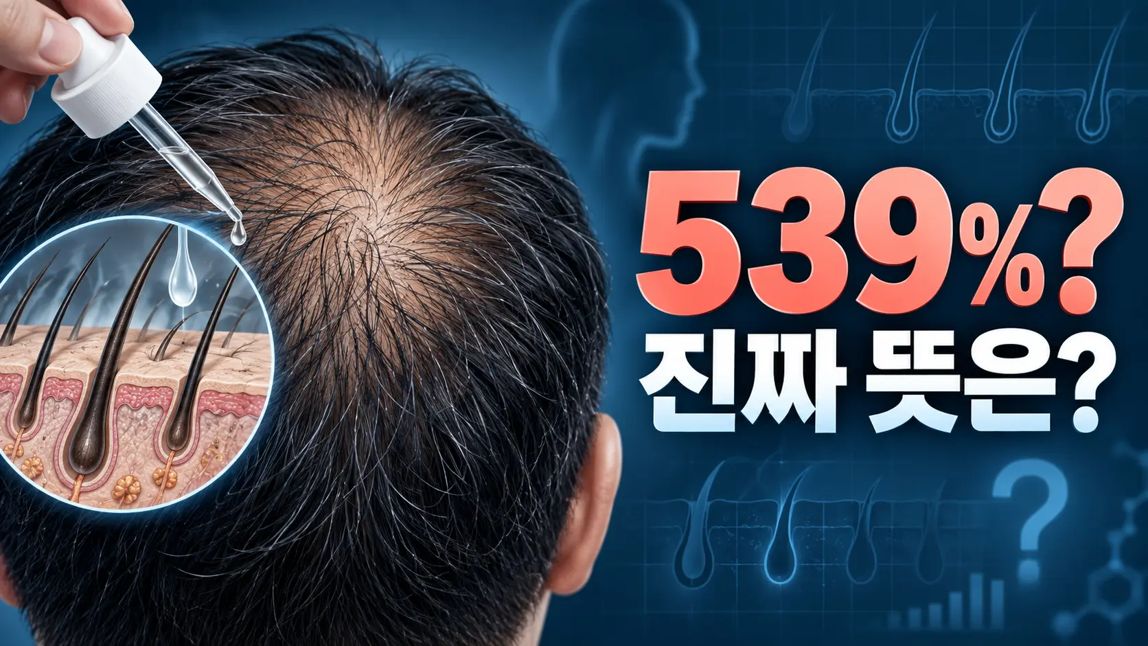 클라스코테론 탈모 신약의 539% 수치가 실제로 무엇을 의미하는지 표현한 일러스트