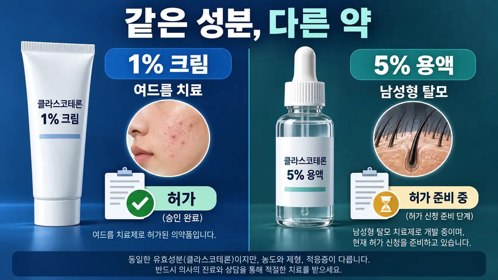 여드름용 클라스코테론 1% 크림과 탈모용 5% 용액의 차이를 설명한 비교 이미지