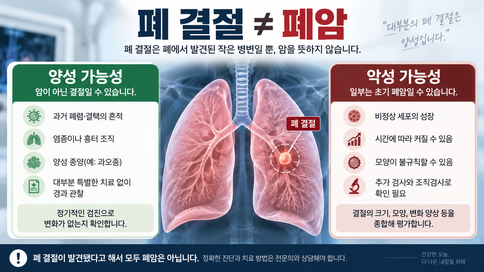 폐 결절이 양성 병변일 수도 있고 악성 병변일 수도 있음을 비교한 의료 인포그래픽