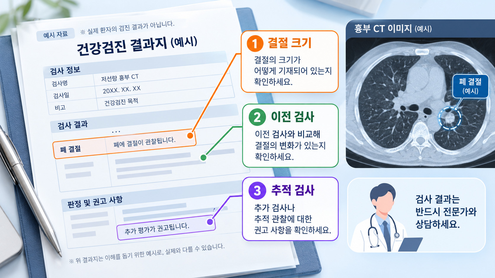 건강검진 결과지에서 폐 결절 크기와 변화, 추가 검사 권고 사항을 확인하는 방법을 설명한 그림